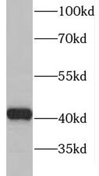 GDAP1L1 Antibody