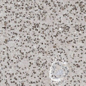 GDAP1L1 Antibody