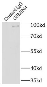 GEMIN4 Rabbit Polyclonal Antibody