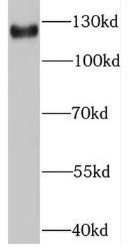 GEMIN4 Rabbit Polyclonal Antibody