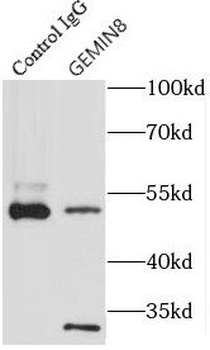GEMIN8 Rabbit Polyclonal Antibody