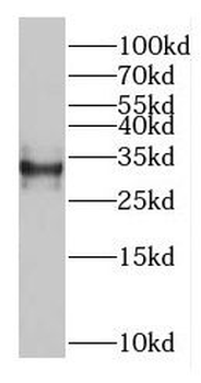 GEMIN8 Rabbit Polyclonal Antibody