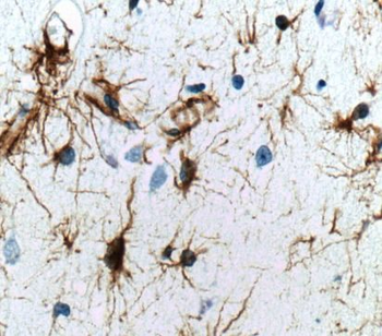GFAP Antibody