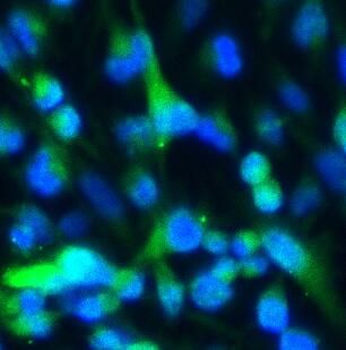 GFAP Antibody