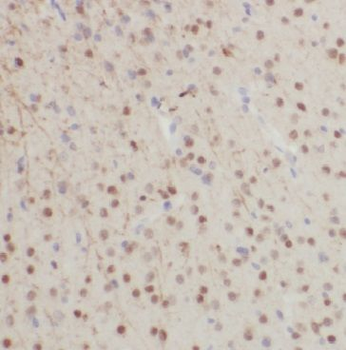 GFAP Antibody