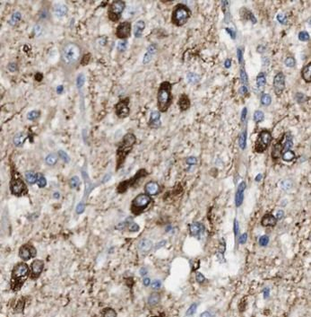 GFAP Antibody