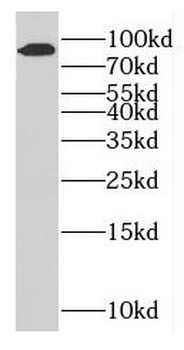 GFM2 Rabbit Polyclonal Antibody