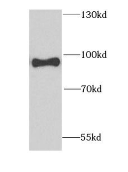 GFPT1 Antibody