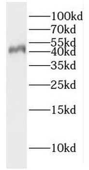 GFRA3 Rabbit Polyclonal Antibody