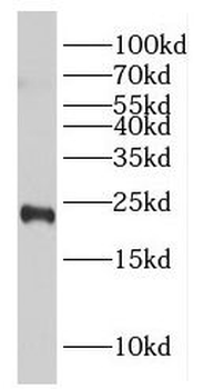 GGCT Rabbit Polyclonal Antibody