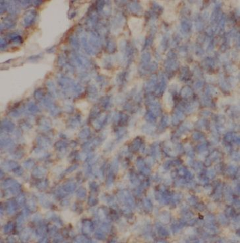 GGCT Rabbit Polyclonal Antibody