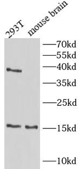 TSC22D3 Rabbit Polyclonal Antibody