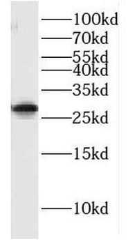 GIMAP2 Rabbit Polyclonal Antibody