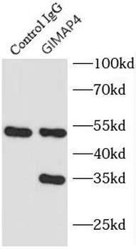 GIMAP4 Rabbit Polyclonal Antibody