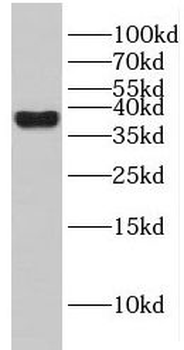 GIMAP4 Rabbit Polyclonal Antibody