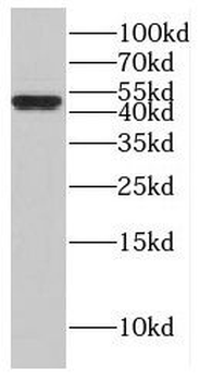 GIMAP5 Rabbit Polyclonal Antibody