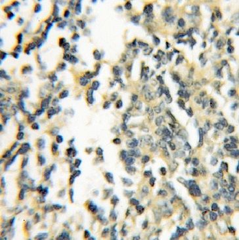 GIMAP5 Rabbit Polyclonal Antibody