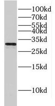 GJB3 Rabbit Polyclonal Antibody