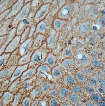 GJB3 Rabbit Polyclonal Antibody