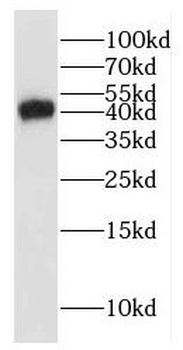 GLI4 Rabbit Polyclonal Antibody