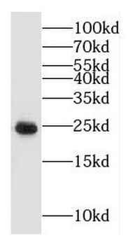 GLIPR1L1 Antibody