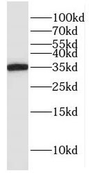 GLOD4 Rabbit Polyclonal Antibody