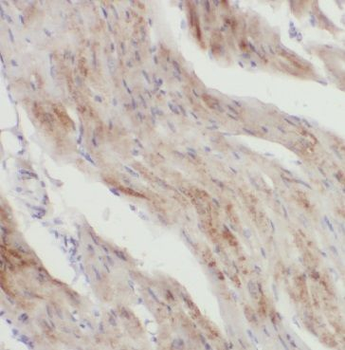 GLOD4 Rabbit Polyclonal Antibody