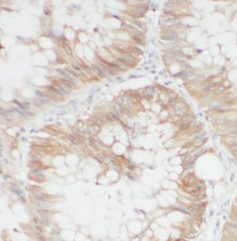 GLRX3 Rabbit Polyclonal Antibody