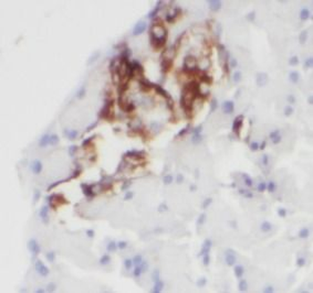GCG Rabbit Polyclonal Antibody
