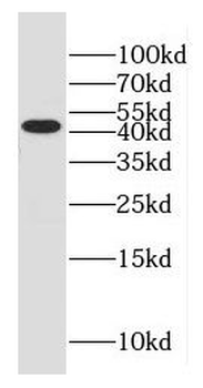 GLUL Rabbit Polyclonal Antibody
