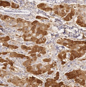 GLUL Rabbit Polyclonal Antibody