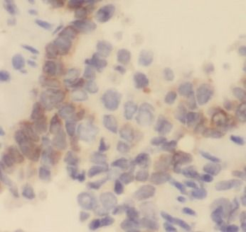 GYPA Rabbit Polyclonal Antibody