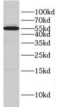 GLYCTK Rabbit Polyclonal Antibody