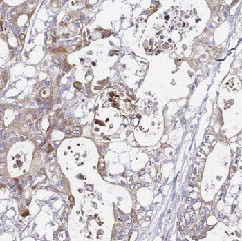 GLYCTK Rabbit Polyclonal Antibody