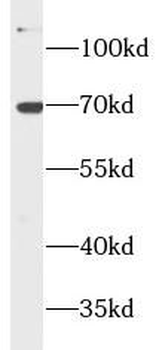 GPC3 Antibody
