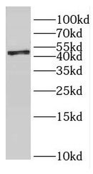 GMPPA Rabbit Polyclonal Antibody