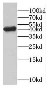 GMPPB Rabbit Polyclonal Antibody