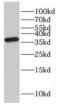 GMPR Rabbit Polyclonal Antibody