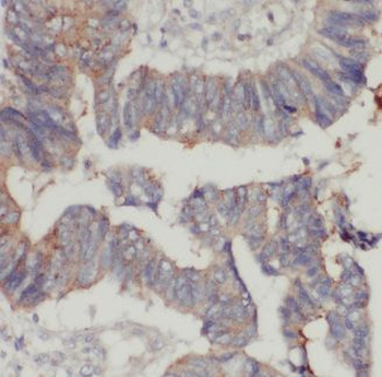 GMPR Rabbit Polyclonal Antibody