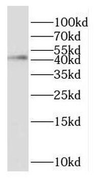 GNAQ Rabbit Polyclonal Antibody