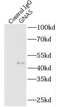 GNAS Rabbit Polyclonal Antibody