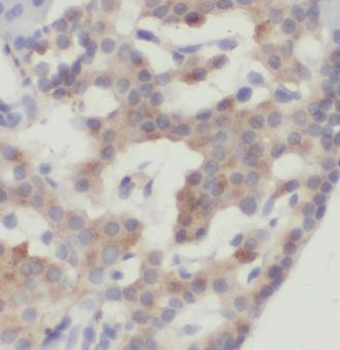 GNAS Rabbit Polyclonal Antibody