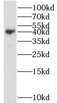 GNAT1 Rabbit Polyclonal Antibody