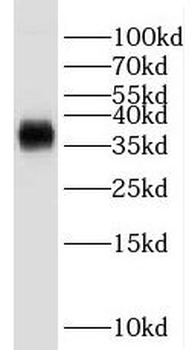 GNB2 Antibody