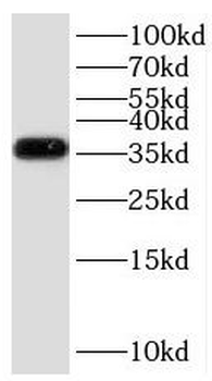 GNB3 Antibody