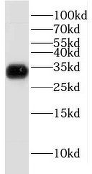 GNMT Rabbit Polyclonal Antibody