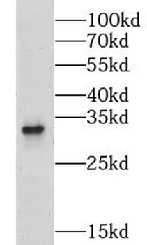 GNRHR2 Rabbit Polyclonal Antibody