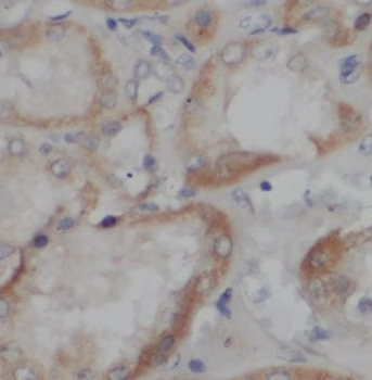 GNRHR2 Rabbit Polyclonal Antibody