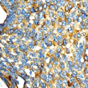 GOLGA2 Rabbit Polyclonal Antibody