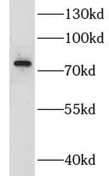 GOLM1 Rabbit Polyclonal Antibody